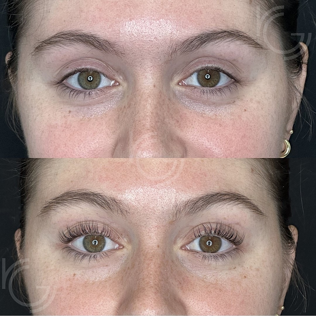 CoolPeel Before & After