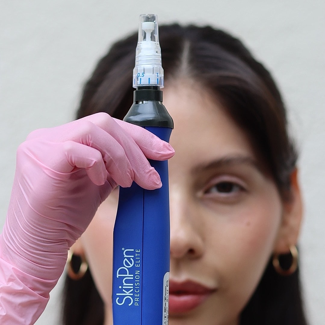SkinPen microneedling device in use